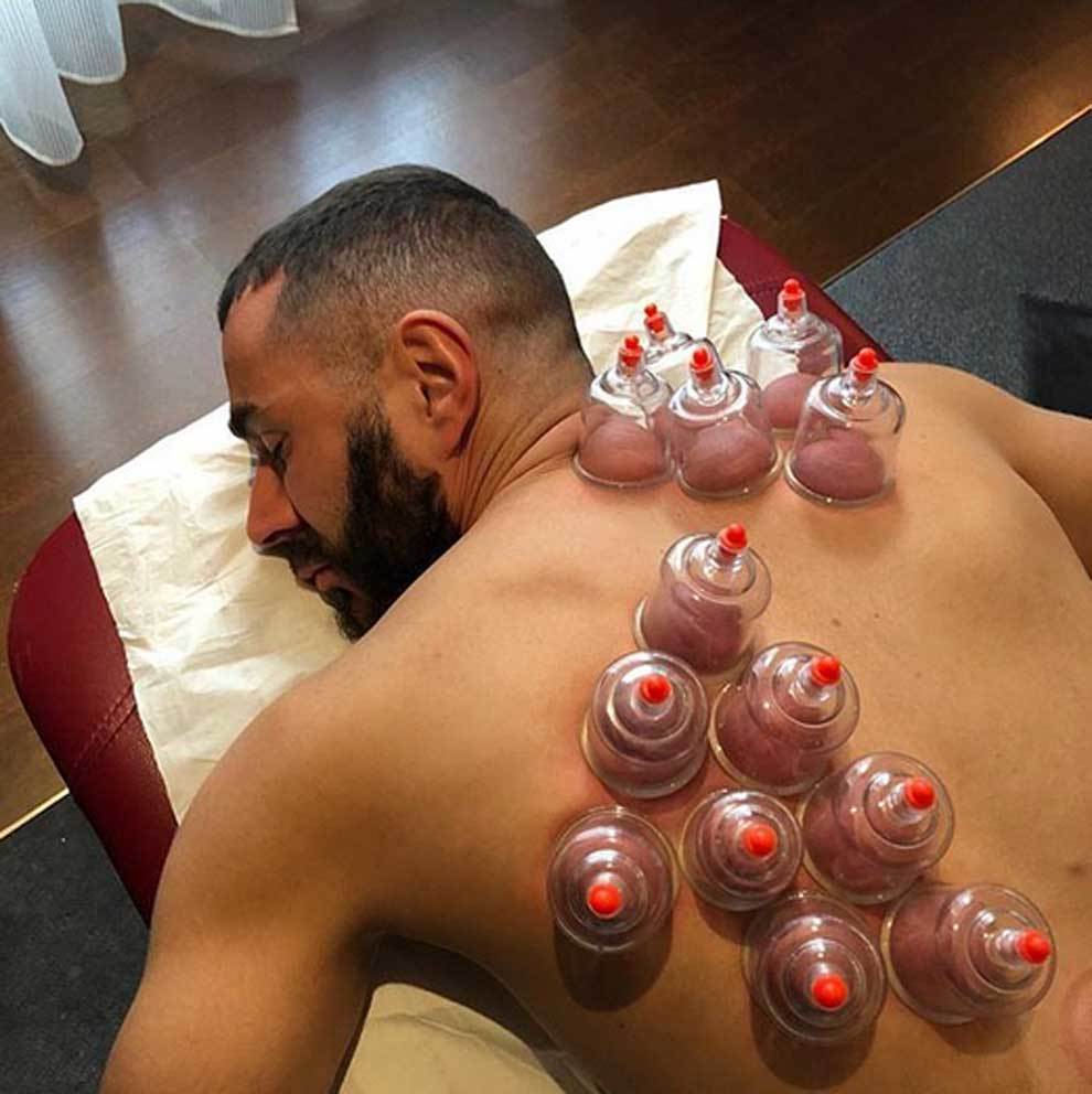 Karim Benzema empleando la ventosaterapia