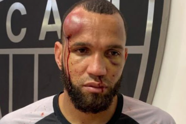 Koka bën, koka e pëson… Ja si përfundoi portieri që nisi sherrin e finales me 23 kartonë të kuq