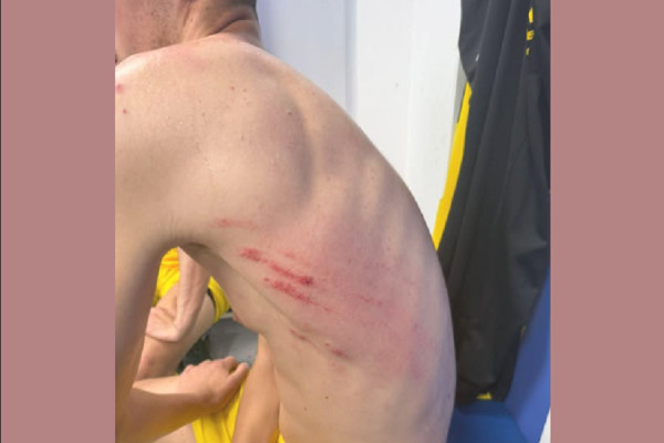 ​Lojtari i Besës së Pejës lëndohet rëndë në ndeshjen me Dinamon, klubi paralajmëron ankesë