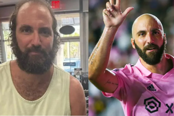 Higuain, zgjidhet misteri: “Fotoja me flokë të gjatë është krijuar me AI”, del imazhi origjinal