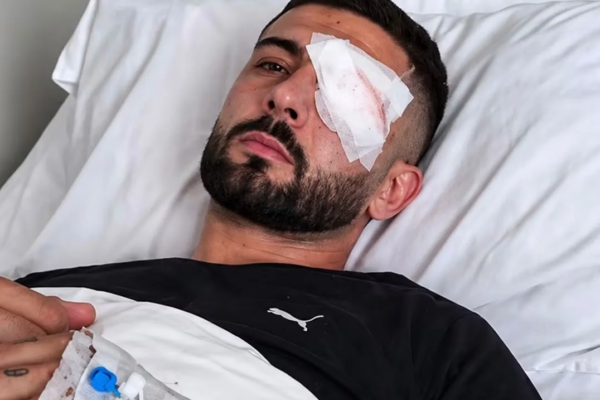 Dëmtimi i Erjon Vishkullit në sy gjatë protestës, Prokuroria nis hetimin penal. Verifikohen edhe rreth 20 raste të tjera