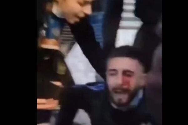 I lënduari në sy gjatë protestës në Tiranë, drejtues i “Tifozave Kuq e Zi”